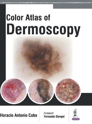 Color Atlas of Dermoscopy - Horacio Cabo