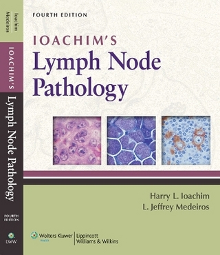 Ioachim's Lymph Node Pathology