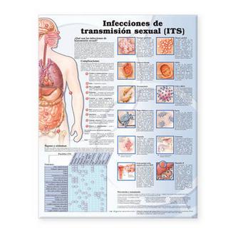 Sexually Transmitted Infections Anatomical Chart in Spanish (Infecciones de transmisión sexual)