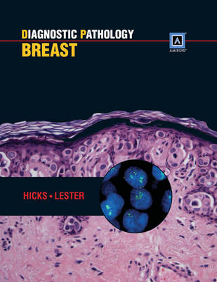 Diagnostic Pathology: Breast - David G. Hicks, Susan C. Lester