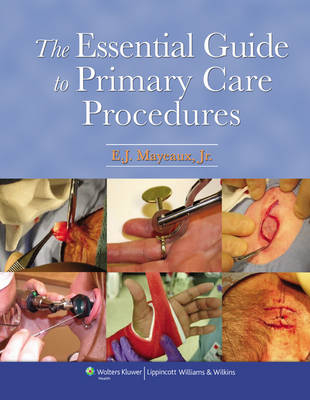 The Essential Guide to Primary Care Procedures - E. J. Mayeaux  Jr.