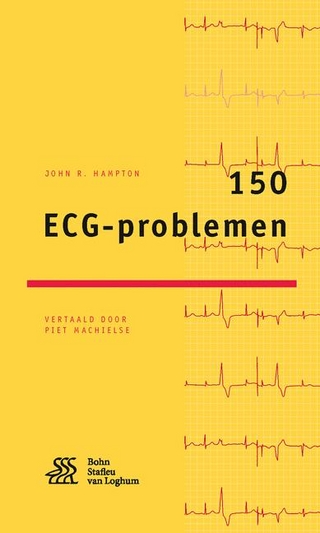 150 Ecg-Problemen