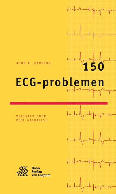 150 Ecg-Problemen - John R Hampton, Piet Machielse