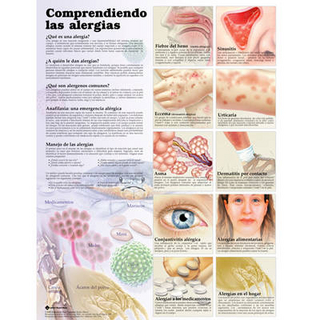 Understanding Allergies Anatomical Chart in Spanish (Entendiendo Las Alergias)