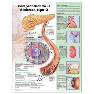 Understanding Type 2 Diabetes Anatomical Chart in Spanish (Comprendiendo la diabetes tipo 2)