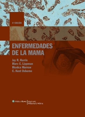 Enfermedades de la mama