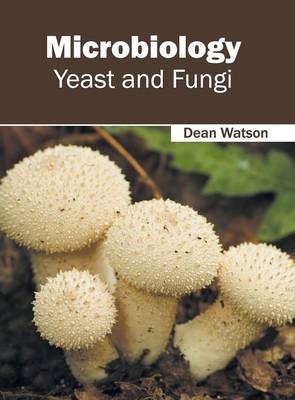 Microbiology: Yeast and Fungi