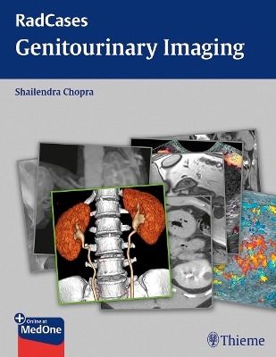 Radcases Genitourinary Imaging