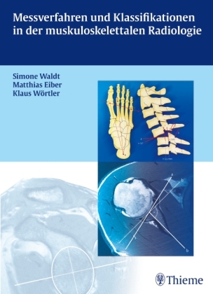 Messverfahren und Klassifikationen in der muskuloskelettalen Radiologie - Simone Waldt, Matthias Eiber, Klaus Wörtler