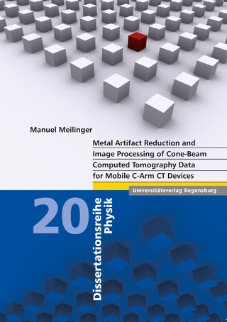 Metal Artifact Reduction and Image Processing of Cone-Beam Computed Tomography Data for Mobile C-Arm CT Devices
