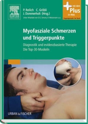 Myofasziale Schmerzen und Triggerpunkte