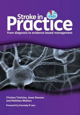 Stroke in Practice - Christos Tziotzios, Jesse Dawson, Matthew Walters