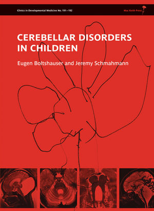 Cerebellar Disorders in Children - 