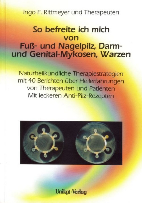 So befreite ich mich von Fuß- und Nagelpilz, Darm- und Genital-Mykosen, Warzen - Ingo F Rittmeyer