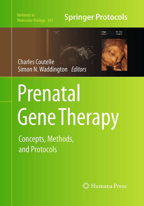 Prenatal Gene Therapy - 