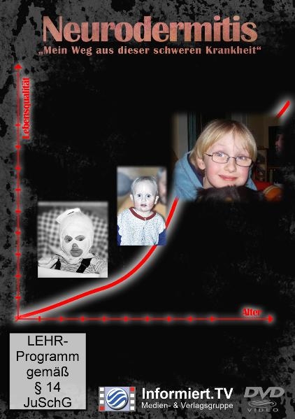 Neurodermitis - Mein Weg aus dieser schweren Krankheit - Tanja Tauner