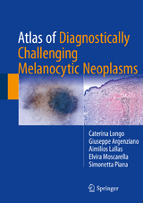 Atlas of Diagnostically Challenging Melanocytic Neoplasms - Caterina Longo, Giuseppe Argenziano, Aimilios Lallas, Elvira Moscarella, Simonetta Piana