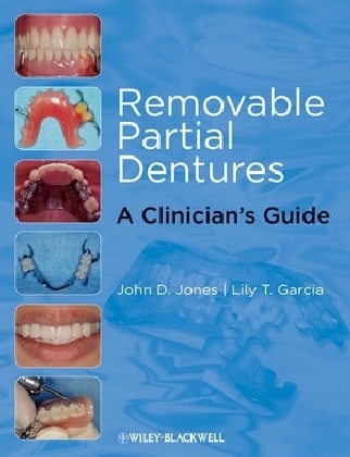 Removable Partial Dentures - John D. Jones, Lily T. Garc&iacute;a