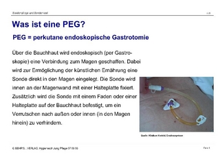 Sondenpflege und Sondenkost