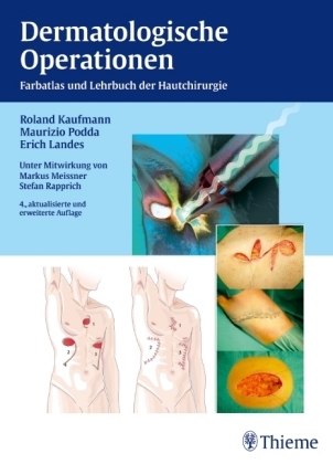 Dermatologische Operationen - Roland Kaufmann, Maurizio Podda, Erich Landes