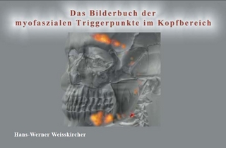 Das Bilderbuch der myofaszialen Schmerzen im Kopfbereich