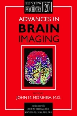 Advances in Brain Imaging - 
