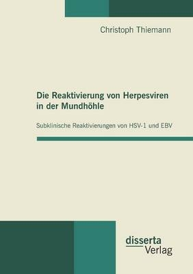 Die Reaktivierung von Herpesviren in der Mundh&ouml;hle: Subklinische Reaktivierungen von HSV-1 und EBV - Christoph Thiemann