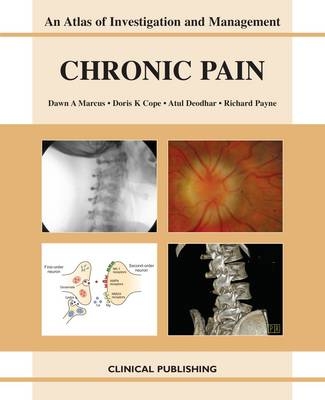 Chronic Pain - Dawn A. Marcus, Doris K. Cope, A. Deodhar, R. Payne