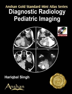Mini Atlas of Diagnostic Radiology: Pediatric Imaging