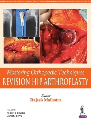 Mastering Orthopedic Techniques: Revision Total Hip Arthroplasty