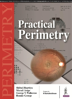 Practical Perimetry