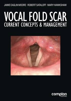 Vocal Fold Scar
