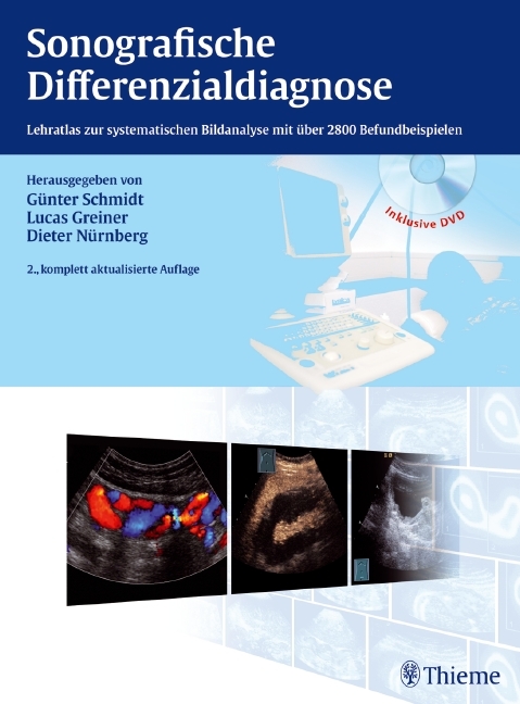 Sonografische Differenzialdiagnose - G&uuml;nter Schmidt, Lucas Greiner, Dieter N&uuml;rnberg