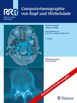 Computertomographie von Kopf und Wirbels&auml;ule