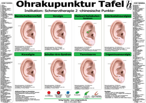 Ohrakupunktur Tafel - Indikation: Schmerztherapie 2 - 