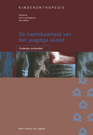 de Kwetsbaarheid Van Het Jeugdige Skelet: Onderste Extremiteit