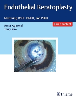 Endothelial Keratoplasty - Amar Agarwal, Terry Kim