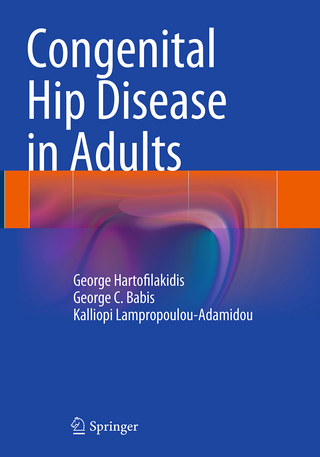 Congenital Hip Disease in Adults