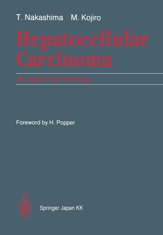 Hepatocellular Carcinoma