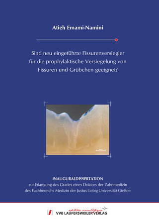 Sind neu eingeführte Fissurenversiegler für die prophylaktische Versiegelung von Fissuren und Grübchen geeignet?