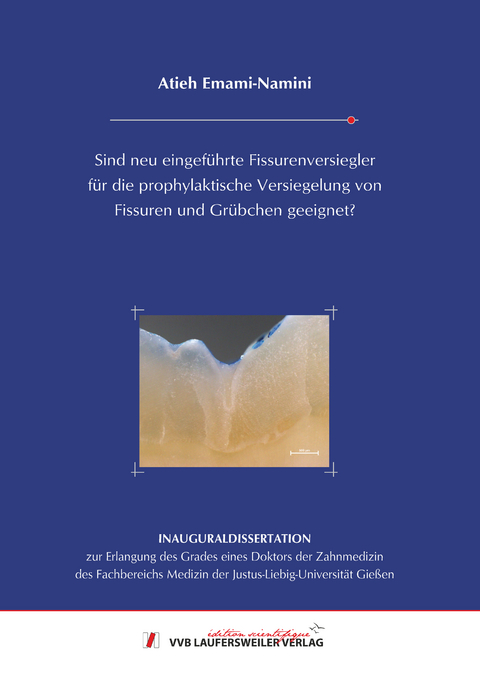 Sind neu eingef&uuml;hrte Fissurenversiegler f&uuml;r die prophylaktische Versiegelung von Fissuren und Gr&uuml;bchen geeignet? - Atieh Emami-Namini