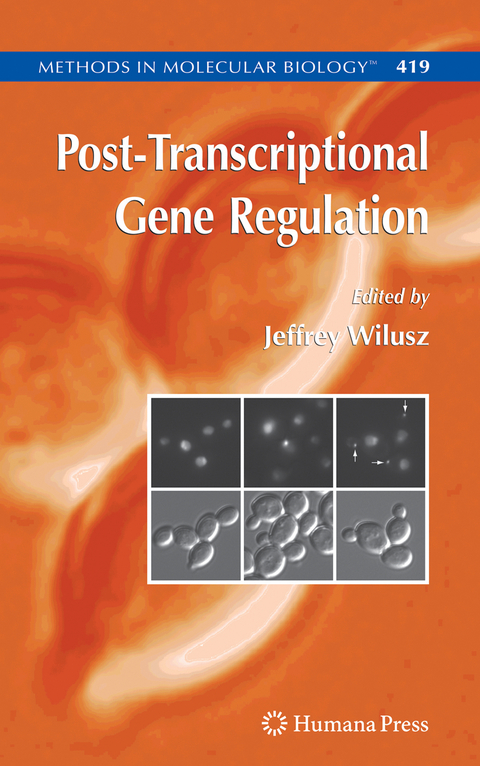 Post-Transcriptional Gene Regulation - 