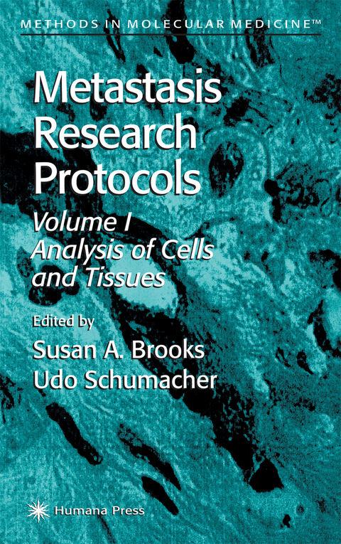 Metastasis Research Protocols - 
