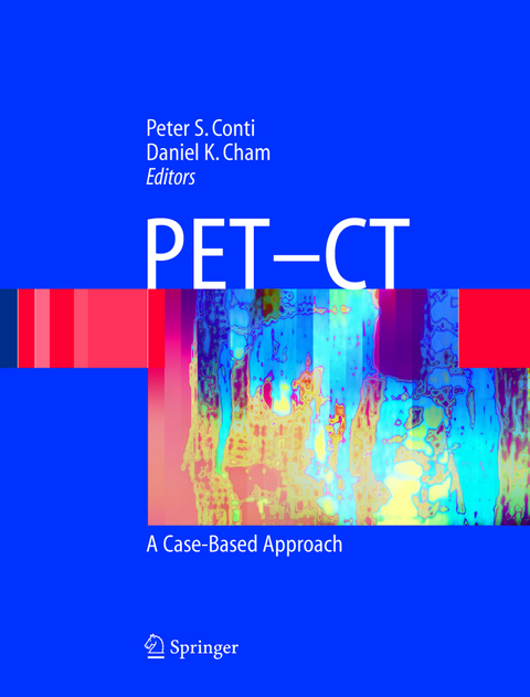 PET-CT - 