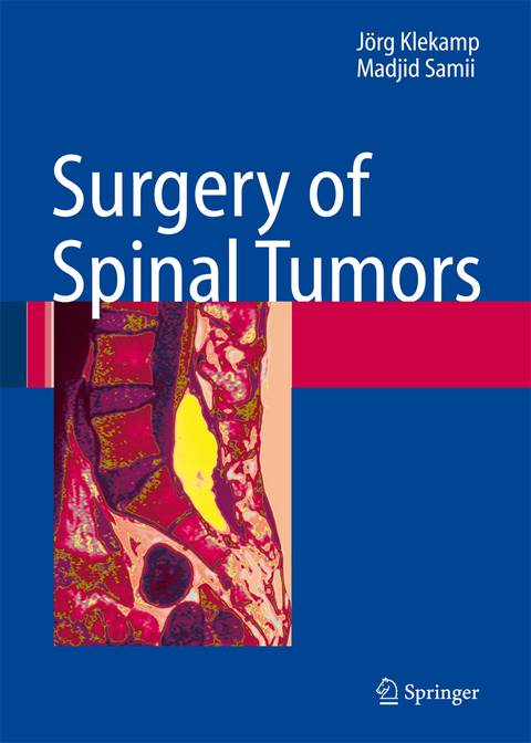 Surgery of Spinal Tumors - J&ouml;rg Klekamp, Madjid Samii