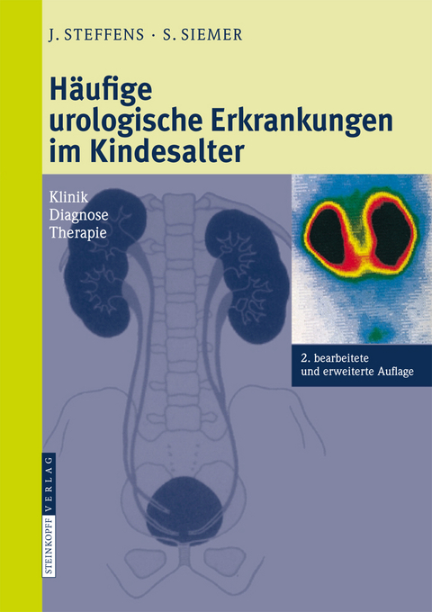 H&auml;ufige urologische Erkrankungen im Kindesalter - Joachim Steffens, Stefan Siemer