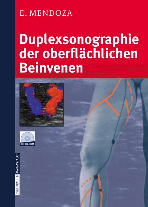 Duplexsonographie der oberfl&auml;chlichen Beinvenen - Erika Mendoza