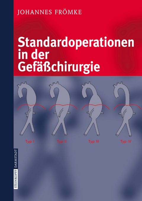 Standardoperationen in der Gef&auml;&szlig;chirurgie - Johannes Fr&ouml;mke