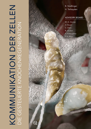 Die gesteuerte Knochenregeneration