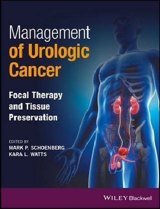 Management of Urologic Cancer